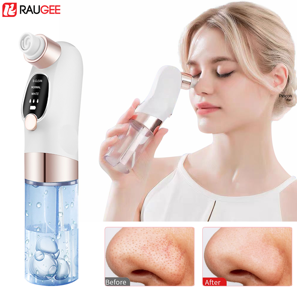 Blackhead Remover Electric Bla - Air Bubble Remover 리뷰 및 가격