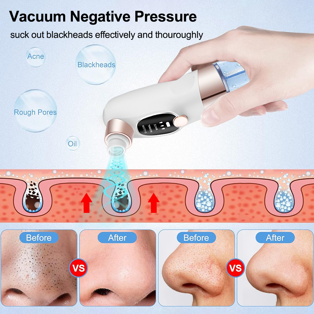 Blackhead Remover Electric Bla - Air Bubble Remover 리뷰 및 가격